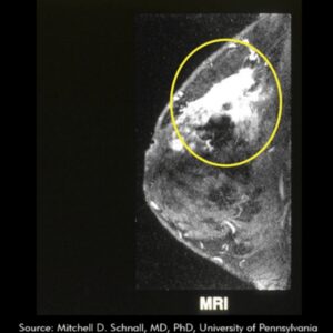 Merit Scout Radar Localisation, MRI Detection
