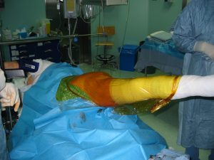 Surgical Draping Systems Iskus Health