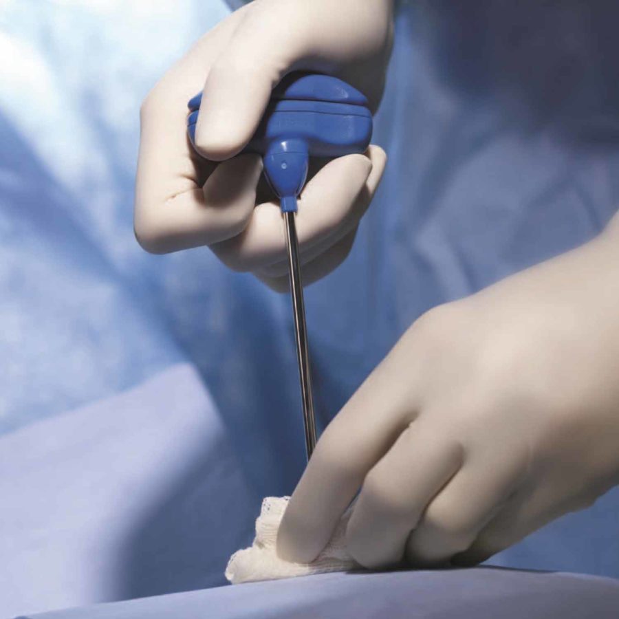 Jamshidi™ bone marrow biopsy needles